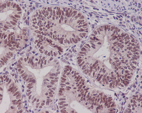 2 - Anti-Pygopus 2 Rabbit Monoclonal Antibody ABO13954