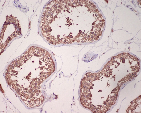 2 - Anti-GRP78 BiP HSPA5 Rabbit Monoclonal Antibody ABO13956