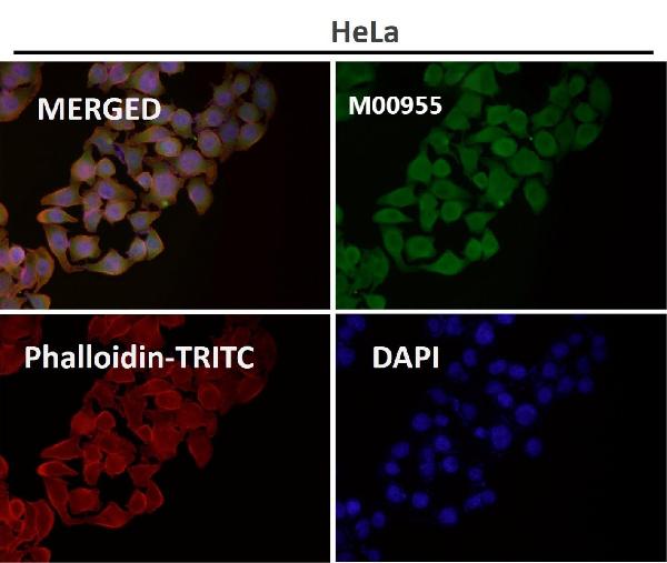 1 - Anti-GRP78 BiP HSPA5 Rabbit Monoclonal Antibody ABO13957