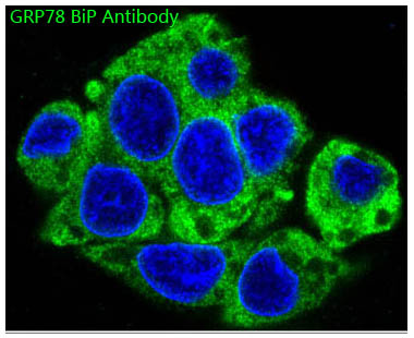 3 - Anti-GRP78 BiP HSPA5 Rabbit Monoclonal Antibody ABO13957
