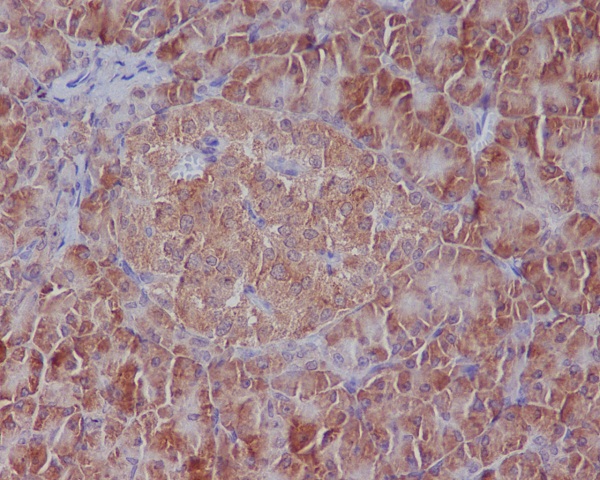 2 - Anti-GRP78 BiP HSPA5 Rabbit Monoclonal Antibody ABO13957