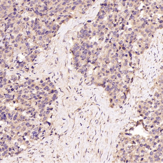 2 - Anti-GRP78 BiP HSPA5 Rabbit Monoclonal Antibody ABO13957