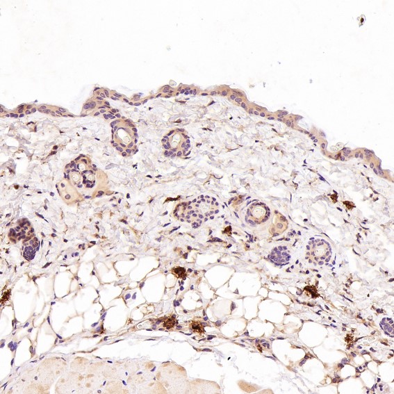 2 - Anti-GRP78 BiP HSPA5 Rabbit Monoclonal Antibody ABO13957