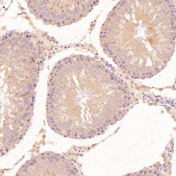 2 - Anti-GRP78 BiP HSPA5 Rabbit Monoclonal Antibody ABO13957