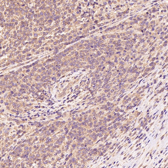2 - Anti-GRP78 BiP HSPA5 Rabbit Monoclonal Antibody ABO13957