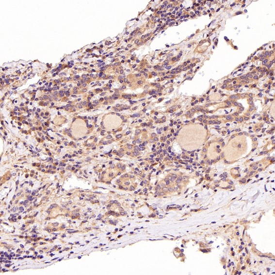 2 - Anti-GRP78 BiP HSPA5 Rabbit Monoclonal Antibody ABO13957