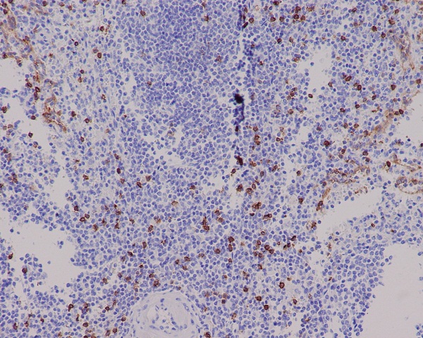 2 - Anti-CD8 alpha Rabbit Monoclonal Antibody ABO13958