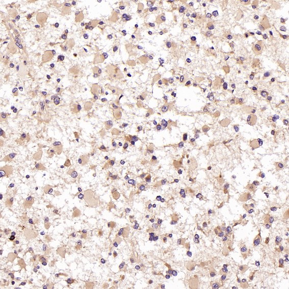 2 - Anti-CD8 alpha Rabbit Monoclonal Antibody ABO13958