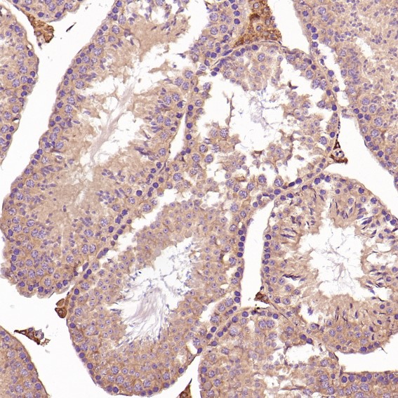 2 - Anti-CD8 alpha Rabbit Monoclonal Antibody ABO13958
