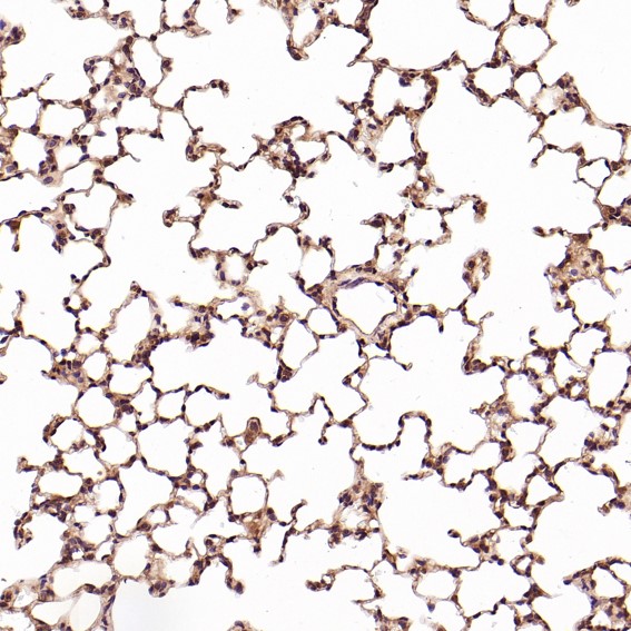 2 - Anti-CD8 alpha Rabbit Monoclonal Antibody ABO13958