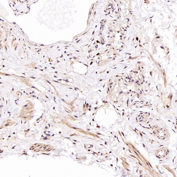 2 - Anti-CD8 alpha Rabbit Monoclonal Antibody ABO13958