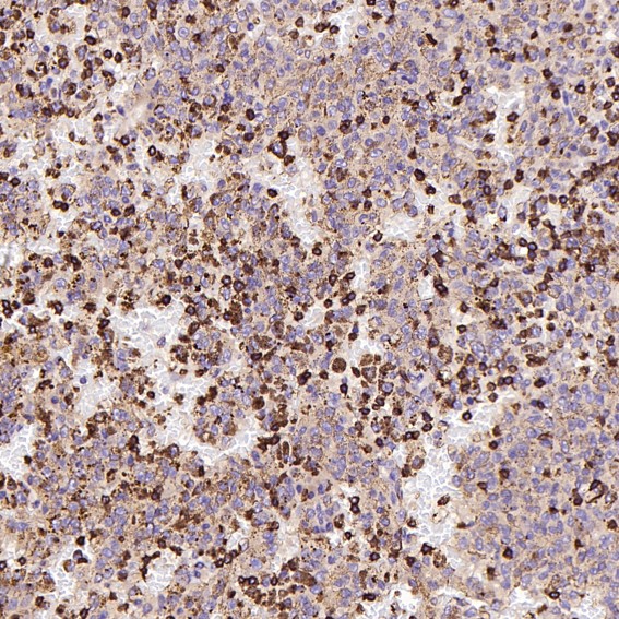 2 - Anti-CD8 alpha Rabbit Monoclonal Antibody ABO13958