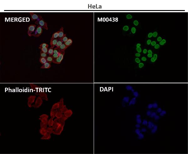 1 - Anti-Lamin A/C LMNA Rabbit Monoclonal Antibody ABO13959