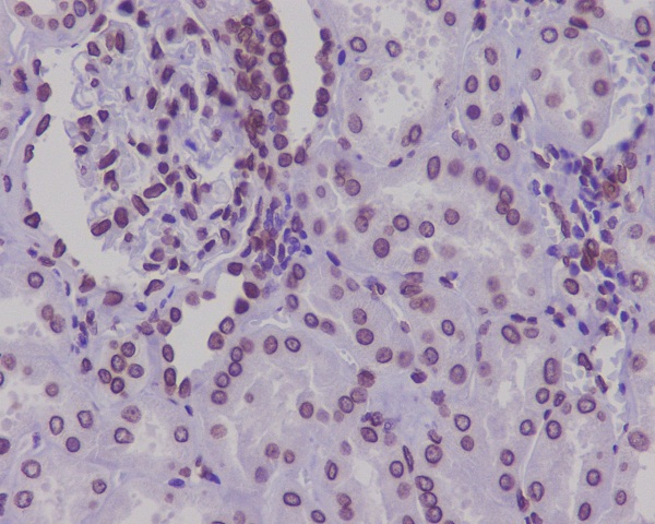 2 - Anti-Lamin A/C LMNA Rabbit Monoclonal Antibody ABO13959