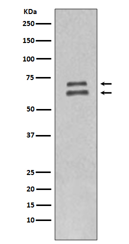 1 - Anti-Lamin A/C LMNA Rabbit Monoclonal Antibody ABO13959