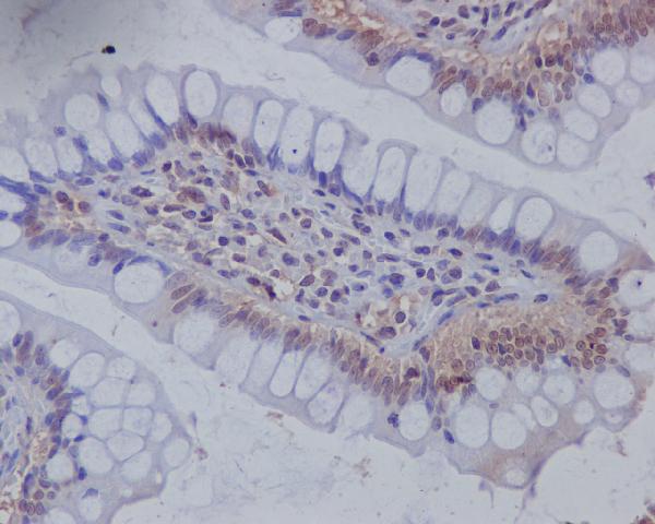 2 - Anti-Musashi 1 MSI1 Rabbit Monoclonal Antibody ABO13960