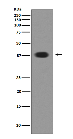 1 - Anti-Musashi 1 MSI1 Rabbit Monoclonal Antibody ABO13960