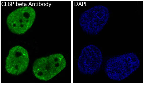 3 - Anti-CEBP beta Rabbit Monoclonal Antibody ABO13961