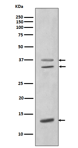 1 - Anti-CEBP beta Rabbit Monoclonal Antibody ABO13961