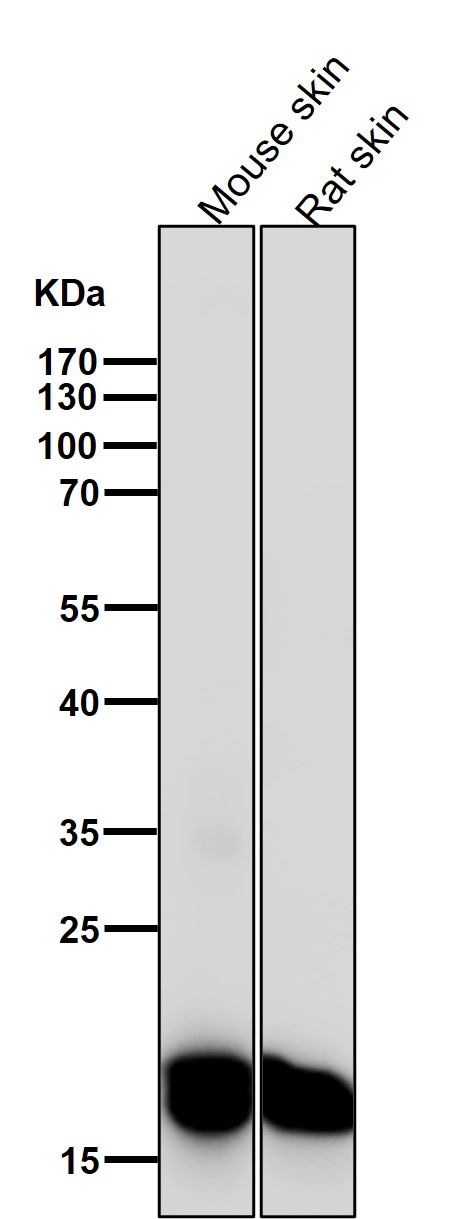 1 - Anti-CEBP beta Rabbit Monoclonal Antibody ABO13961