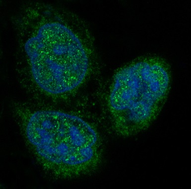 3 - Anti-p27 KIP 1 CDKN1B Rabbit Monoclonal Antibody ABO13962