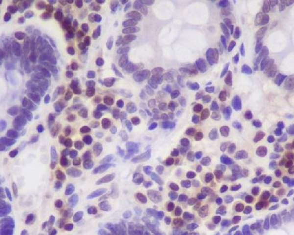 2 - Anti-p27 KIP 1 CDKN1B Rabbit Monoclonal Antibody ABO13962