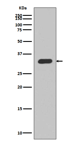 1 - Anti-p27 KIP 1 CDKN1B Rabbit Monoclonal Antibody ABO13962