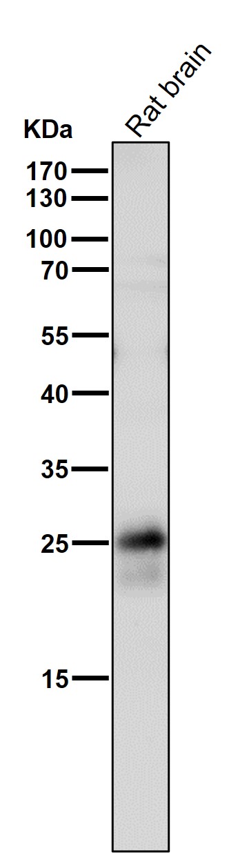 1 - Anti-p27 KIP 1 CDKN1B Rabbit Monoclonal Antibody ABO13962
