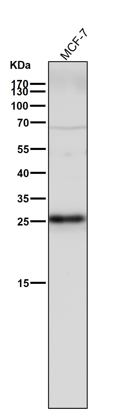 1 - Anti-p27 KIP 1 CDKN1B Rabbit Monoclonal Antibody ABO13962
