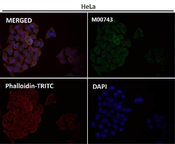 1 - Anti-PKC alpha PRKCA Rabbit Monoclonal Antibody ABO13963