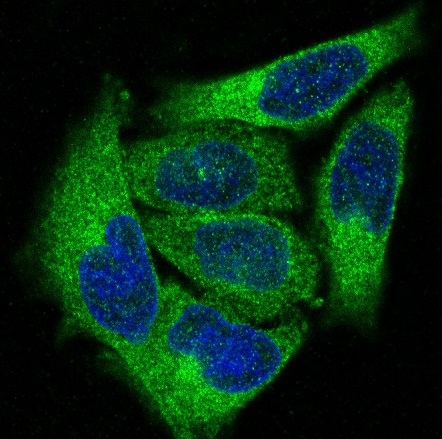 3 - Anti-PKC alpha PRKCA Rabbit Monoclonal Antibody ABO13963