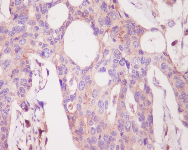 2 - Anti-PKC alpha PRKCA Rabbit Monoclonal Antibody ABO13963