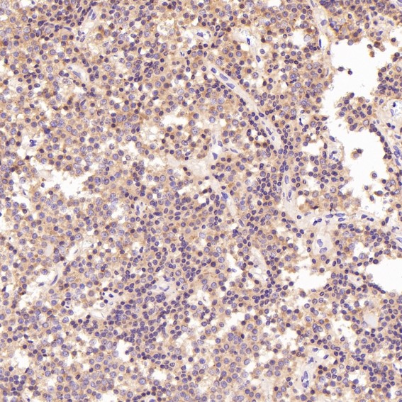2 - Anti-PKC alpha PRKCA Rabbit Monoclonal Antibody ABO13963