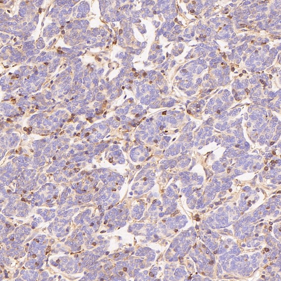 2 - Anti-PKC alpha PRKCA Rabbit Monoclonal Antibody ABO13963
