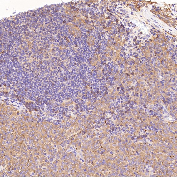 2 - Anti-PKC alpha PRKCA Rabbit Monoclonal Antibody ABO13963