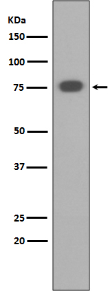 1 - Anti-PKC alpha PRKCA Rabbit Monoclonal Antibody ABO13963