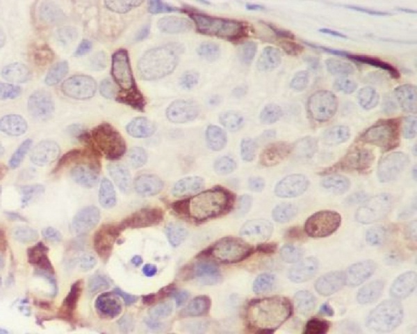 2 - Anti-Cyclin B1 CCNB1 Rabbit Monoclonal Antibody ABO13965