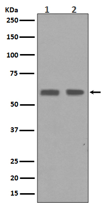 1 - Anti-Cyclin B1 CCNB1 Rabbit Monoclonal Antibody ABO13965