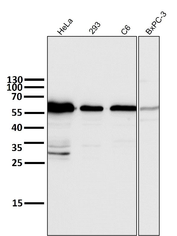 1 - Anti-Cyclin B1 CCNB1 Rabbit Monoclonal Antibody ABO13965
