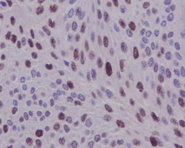 2 - Anti-Cyclin D1 CCND1 Rabbit Monoclonal Antibody ABO13966