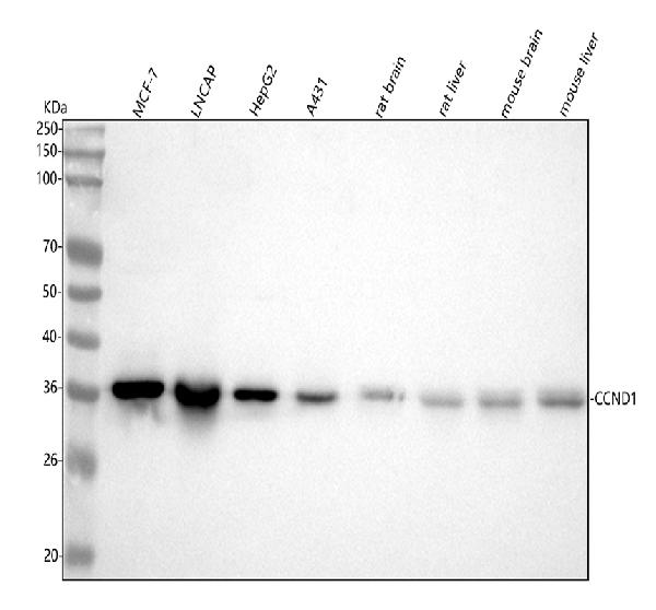 1 - Anti-Cyclin D1 CCND1 Rabbit Monoclonal Antibody ABO13966
