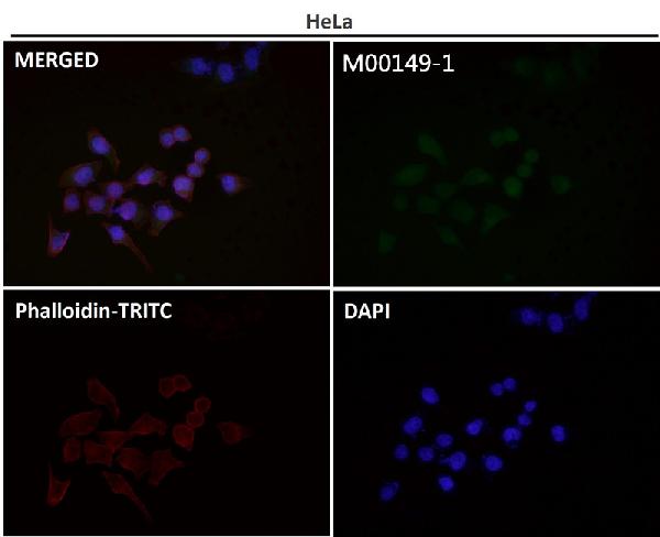 1 - Anti-Cyclin D1 CCND1 Rabbit Monoclonal Antibody ABO13966