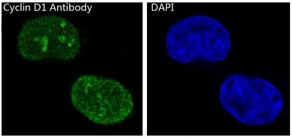 3 - Anti-Cyclin D1 CCND1 Rabbit Monoclonal Antibody ABO13966