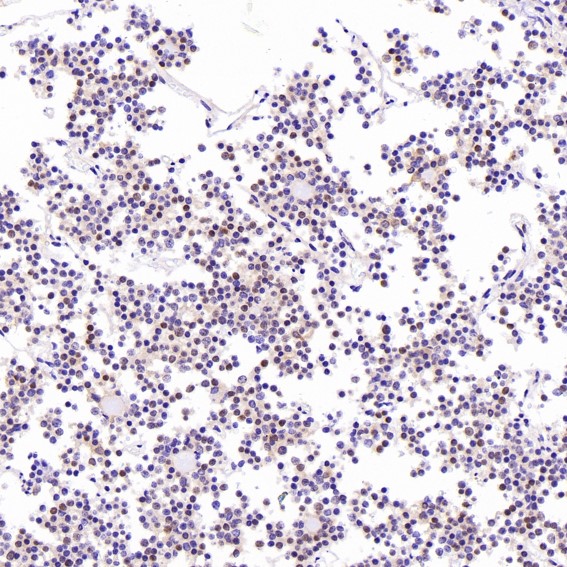 2 - Anti-Cyclin D1 CCND1 Rabbit Monoclonal Antibody ABO13966