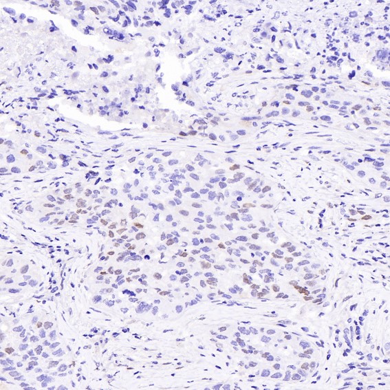 2 - Anti-Cyclin D1 CCND1 Rabbit Monoclonal Antibody ABO13966