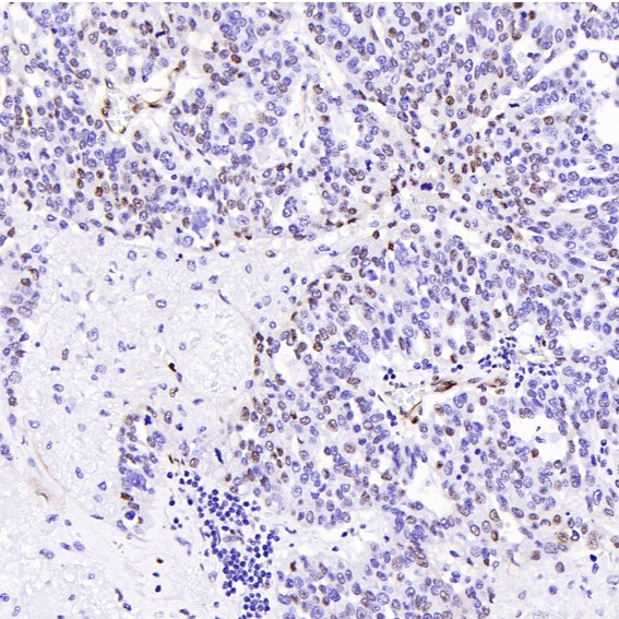 2 - Anti-Cyclin D1 CCND1 Rabbit Monoclonal Antibody ABO13966