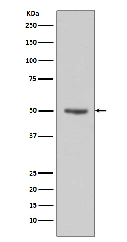 1 - Anti-Cyclin E1 CCNE1 Rabbit Monoclonal Antibody ABO13968