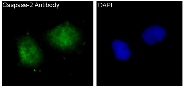 3 - Anti-Caspase-2 CASP2 Rabbit Monoclonal Antibody ABO13969