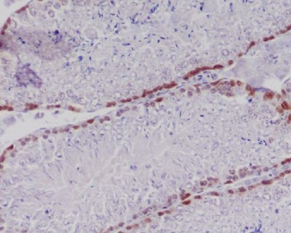 2 - Anti-Caspase-2 CASP2 Rabbit Monoclonal Antibody ABO13969