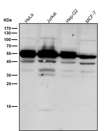 1 - Anti-Caspase-2 CASP2 Rabbit Monoclonal Antibody ABO13969